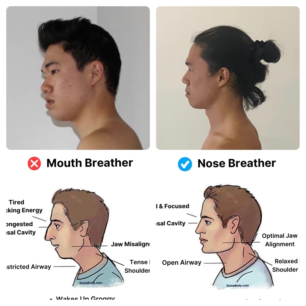 SomaBody Mouthtape - Better Sleep, Less Snoring, More Nosebreathing