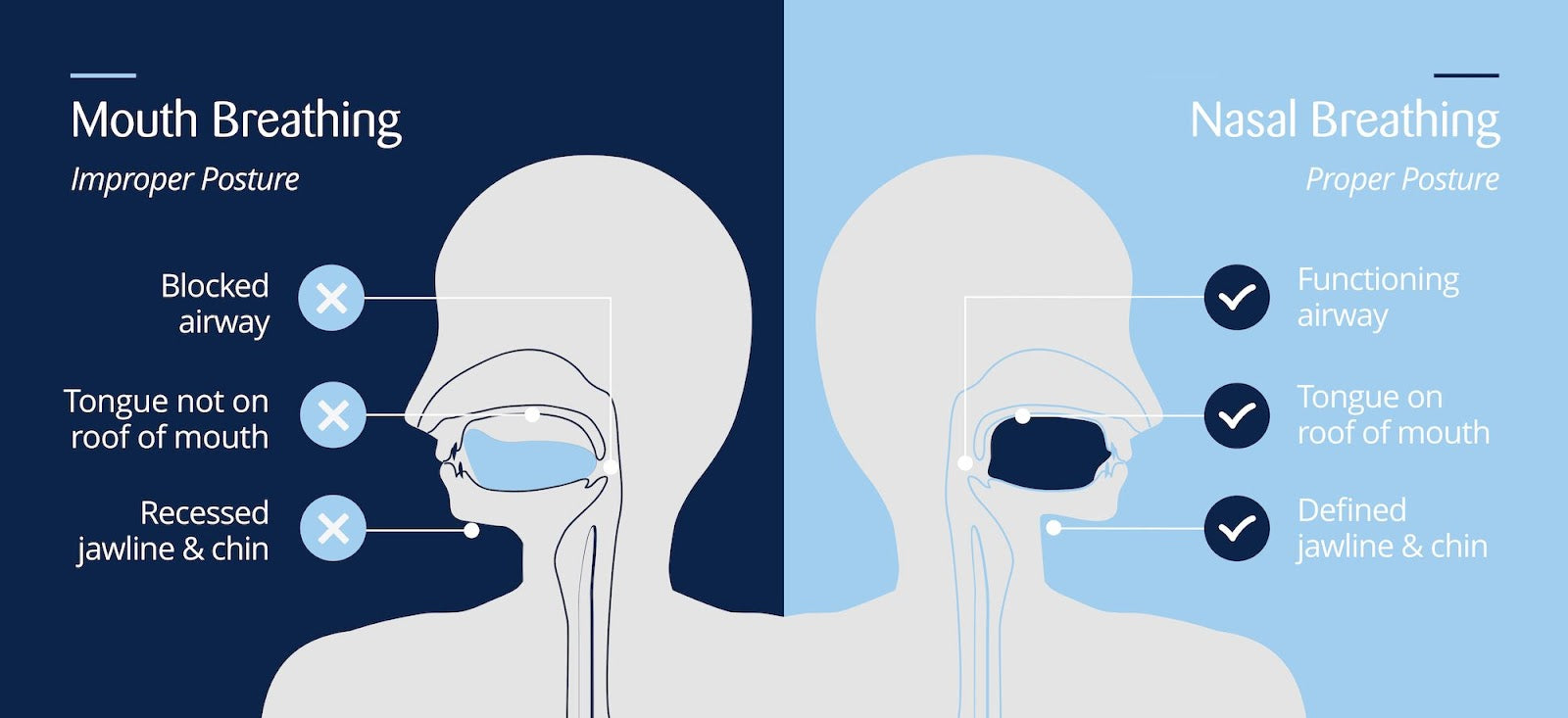 How Mouth Breathing Could Be Damaging Your Health – Somabody Health